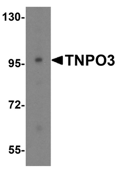 TNPO3 Antibody