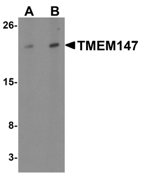 TMEM147 Antibody