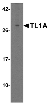 TL1A Antibody