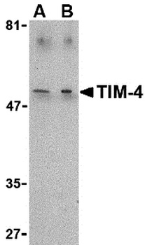 TIMD4 Antibody