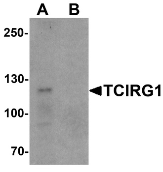 TCIRG1 Antibody