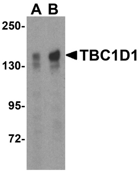 TBC1D1 Antibody