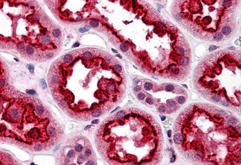 TAB3 Antibody