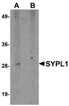 SYPL1 Antibody