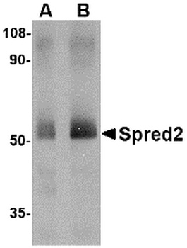 SPRED2 Antibody