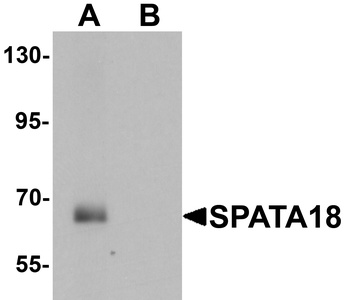 SPATA18 Antibody