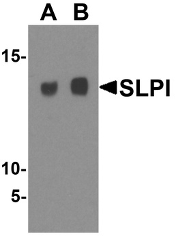 SLPI Antibody