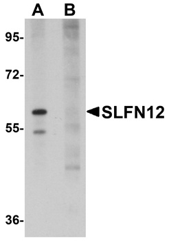 SLFN12 Antibody