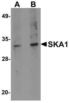 SKA1 Antibody