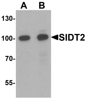 SIDT2 Antibody