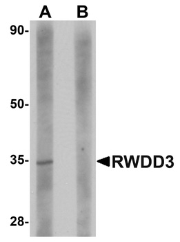 RWDD3 Antibody