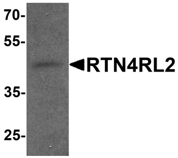 RTN4RL2 Antibody