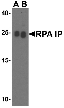 RPA Interacting Protein Antibody
