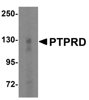 PTPRD Antibody