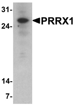 PRRX1 Antibody