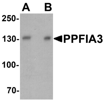 PPFIA3 Antibody