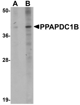 PPAPDC1B Antibody