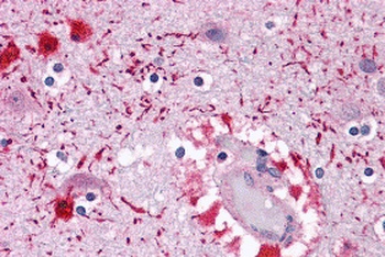 PIWI-L2 Antibody