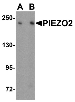 PIEZO2 Antibody