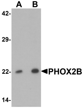 PHOX2B Antibody