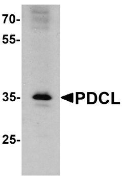 PDCL Antibody