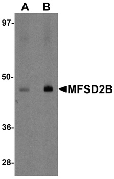 MFSD2B Antibody
