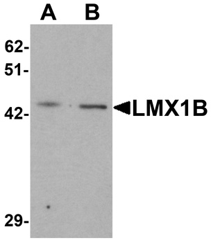LMX1B Antibody