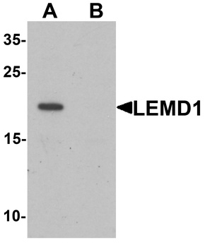 LEMD1 Antibody