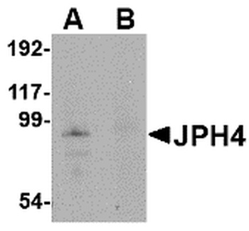 JPH4 Antibody