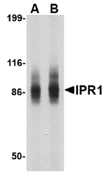 SP110 Antibody
