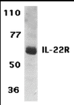 IL-22 Receptor Antibody