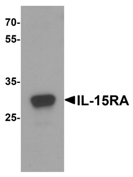 IL15RA Antibody