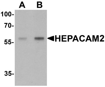 HEPACAM2 Antibody