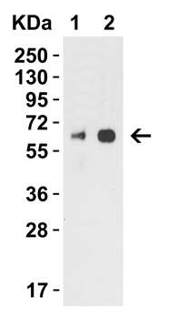 H1N1 Neuraminidase Antibody