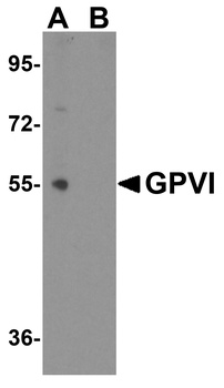 GP6 Antibody