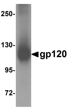 gp120 Antibody
