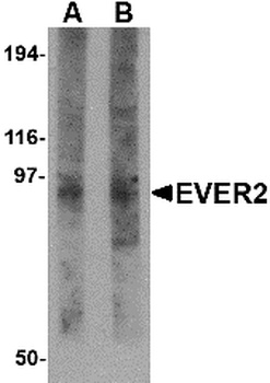 TMC8 Antibody