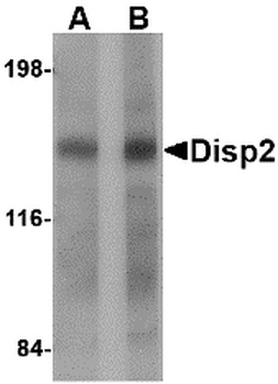 DISP2 Antibody