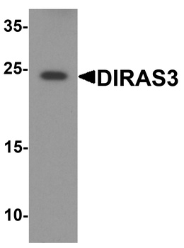 DIRAS3 Antibody