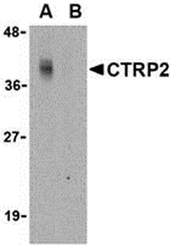 C1QTNF2 Antibody