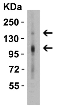 CRB2 Antibody