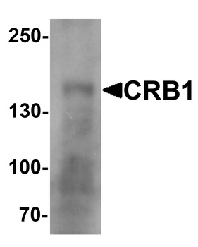 CRB1 Antibody