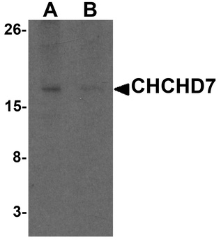 CHCHD7 Antibody
