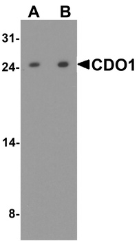 CDO1 Antibody