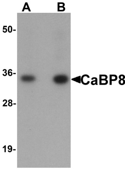 CALN1 Antibody