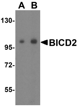 BICD2 Antibody