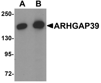 ARHGAP39 Antibody