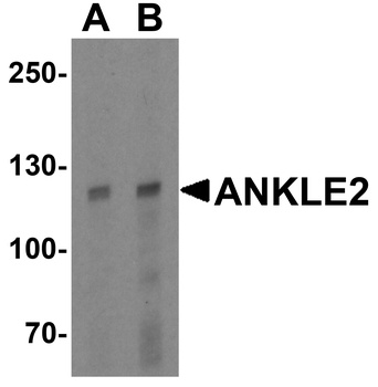 ANKLE2 Antibody