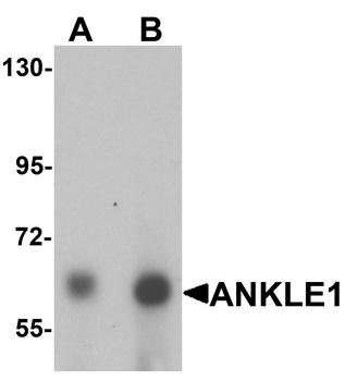 ANKLE1 Antibody
