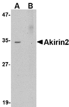 AKIRIN2 Antibody